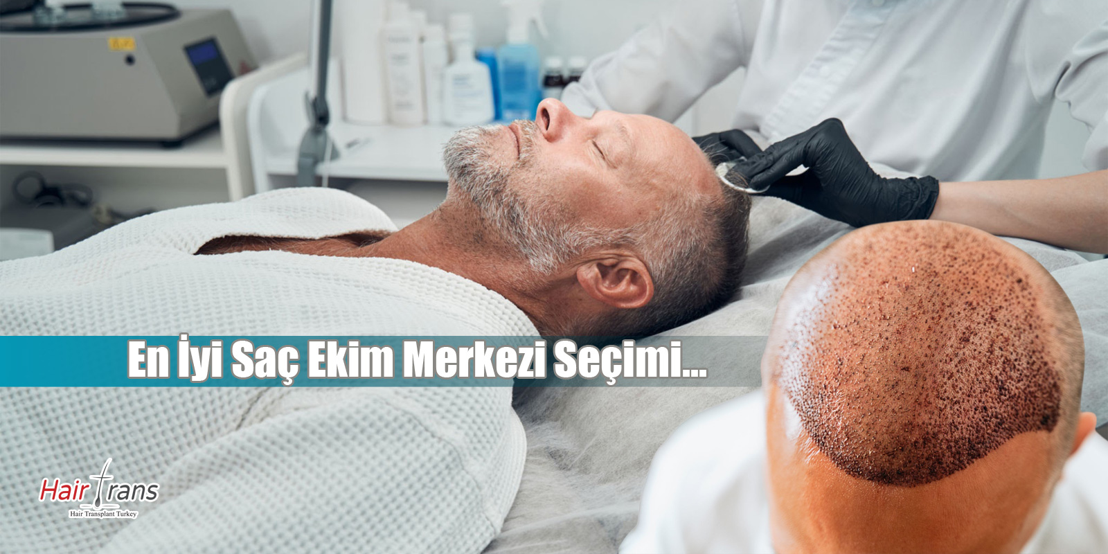 En İyi Saç Ekim Merkezi Seçimi