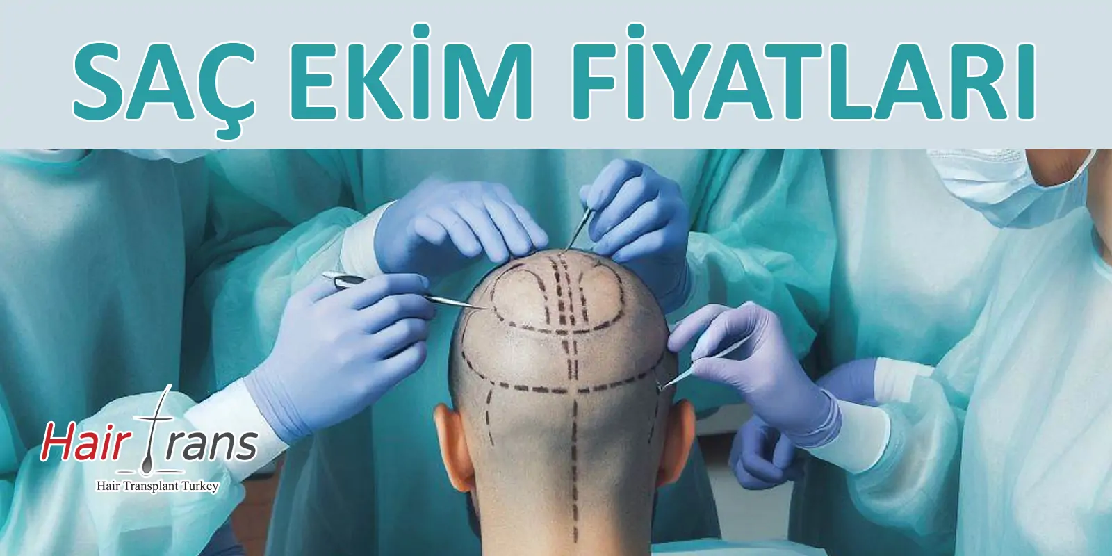 Saç Ekimi Fiyatları 2025 Saç Ekimi Fiyatları 2025